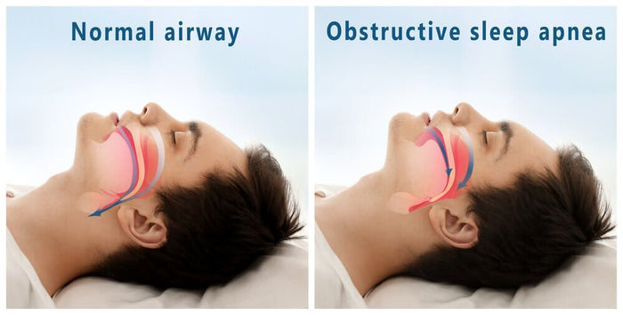 Can Your Mattress Help Sleep Apnea? - TheSleepLoft